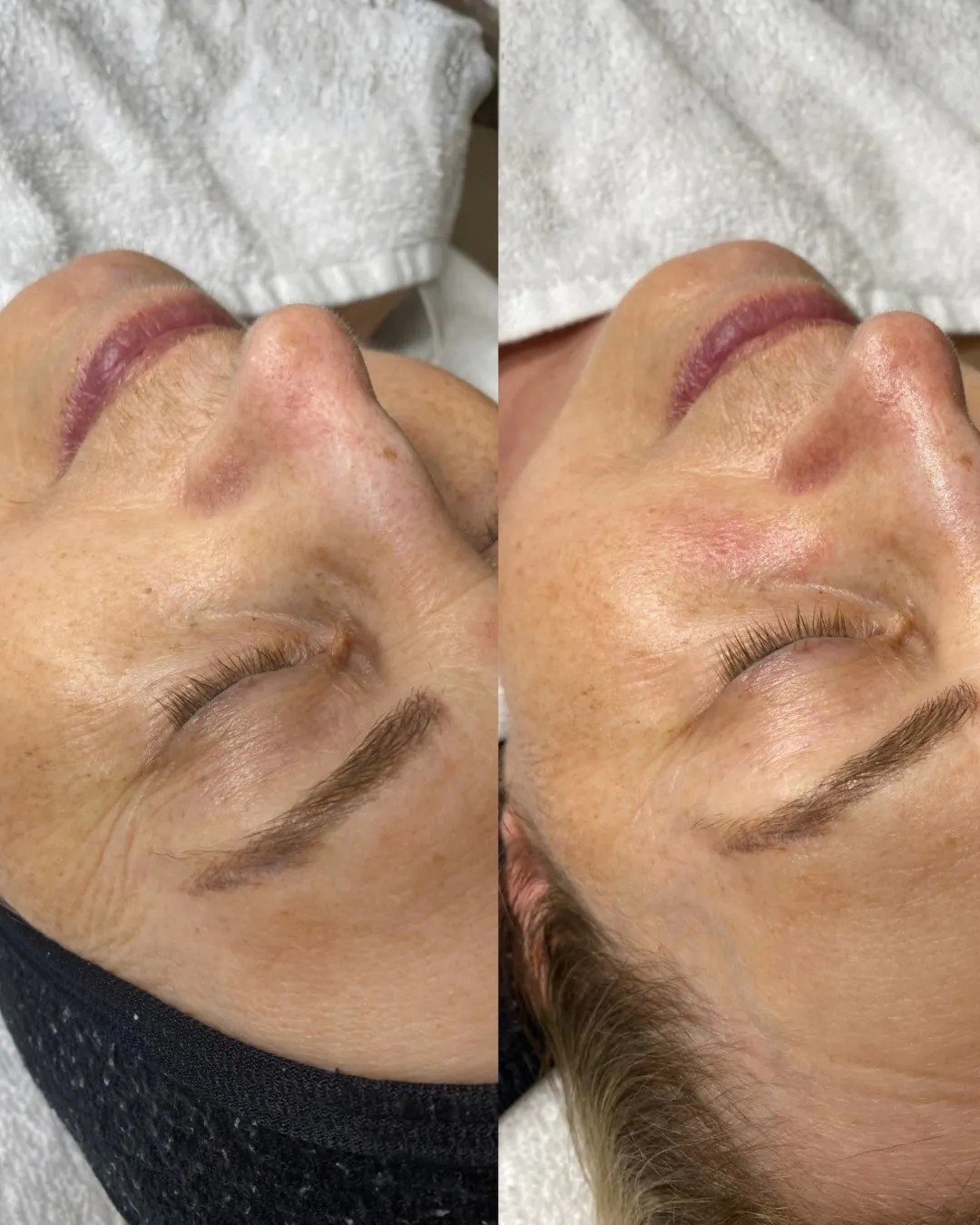 Permanentní make-up obočí – před a po